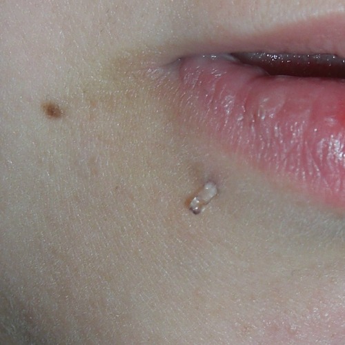 Labret retainer