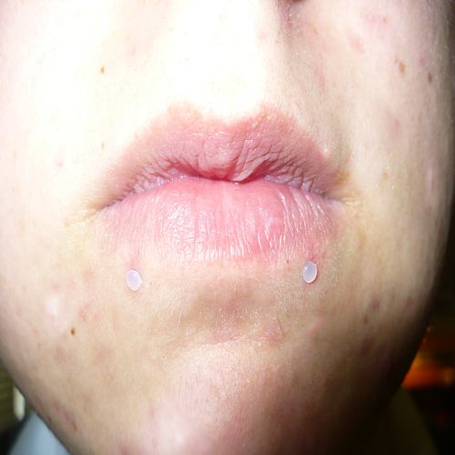 Flexible labret retainer