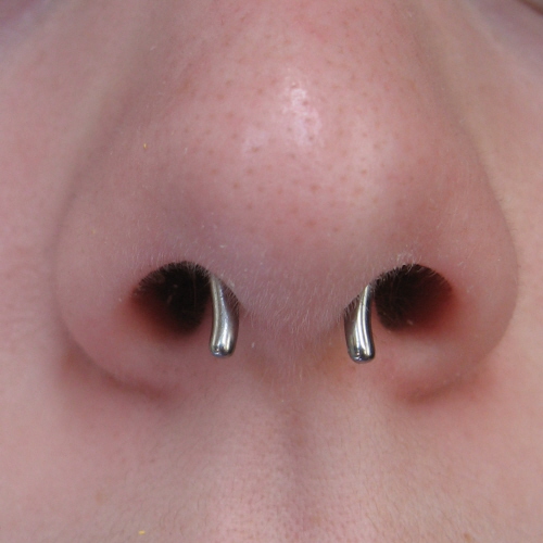 Titanium septum retainer
