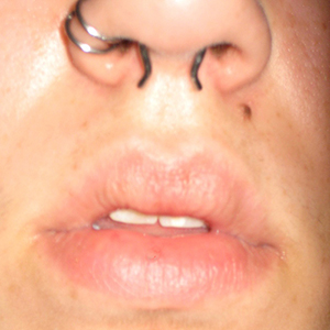 Click to enlarge