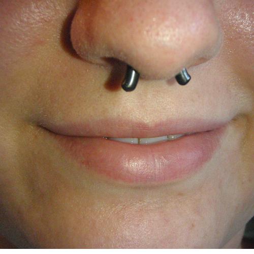 Black niobium septum retainer