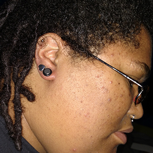 Economy Stretching Kit with Acrylic Taper Customer Photo