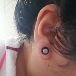 Stainless Steel Stretching Kit Customer Photo