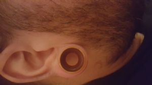 Mixed Wood Plugs Customer Photo