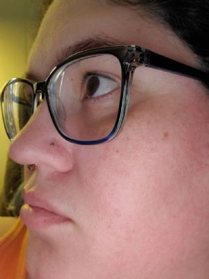 Flat Disc Nosescrew Customer Photo