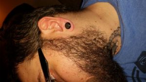 Stainless Steel Stretching Kit Customer Photo