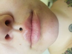 Glass Nosebone Customer Photo
