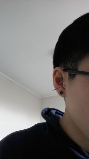 Titanium Threadless Insertion Taper Customer Photo