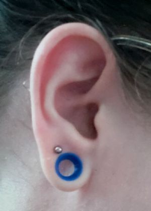 Titanium Internally Threaded Labret Customer Photo