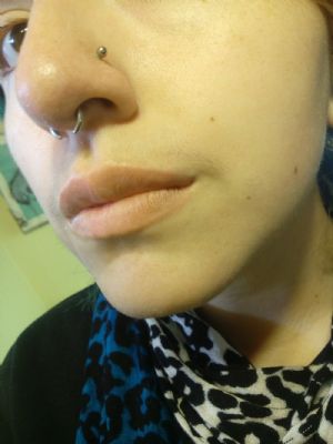 Titanium Internally Threaded Labret Customer Photo