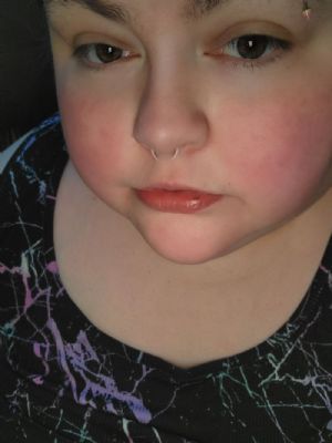 Soft Touch Bioflex Septum Pincher Customer Photo