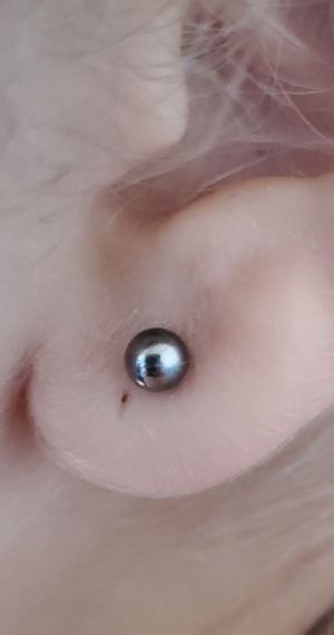 Titanium Ball Front Earrings Customer Photo