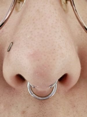 Steel Septum Pincher Customer Photo