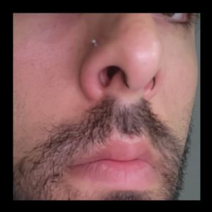 Steel Septum Pincher Customer Photo