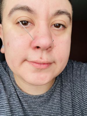 Titanium Internally Threaded Tapers Customer Photo