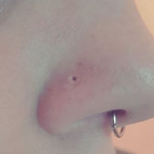 Bioplast Nosebone Customer Photo