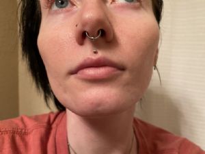 Captive Clicker Ring Customer Photo