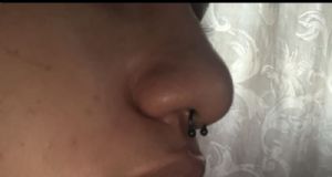 Internally Threaded Titanium Circular Barbell Customer Photo