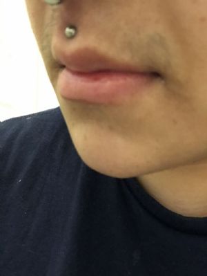 Titanium Dome Threaded End Customer Photo