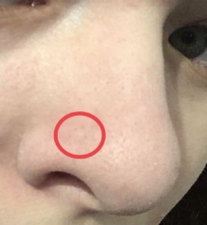 Silicone Hook Retainer Customer Photo