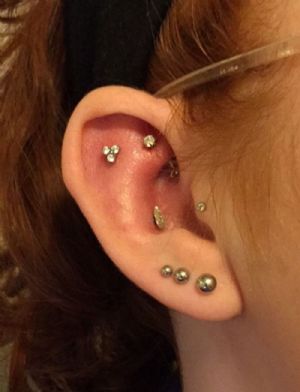 Titanium Trinity Cluster Threaded End Customer Photo