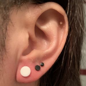 Silicone Solid Front Plug Customer Photo