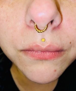 Sequence Septum Clicker Customer Photo