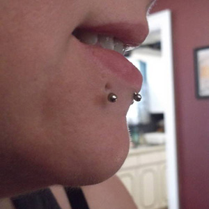 PTFE Labret Customer Photo
