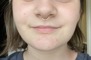 Steel Clicker Ring Customer Photo