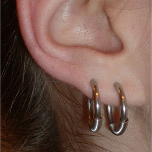 Cobra Coil Captive Customer Photo