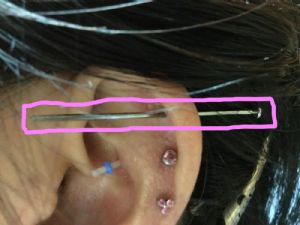 Titanium Threadless Insertion Taper Customer Photo