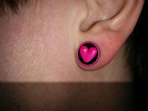 Blemished Silicone Design Front Plugs Customer Photo