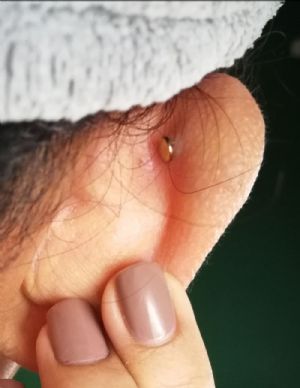 Titanium Threadless Labret Post Customer Photo