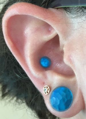 CUSTOM ORDER Simple Solid Martele Plug Customer Photo