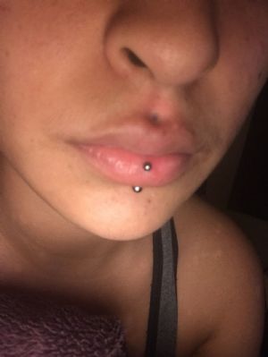 Silicone Heart Retainer Customer Photo