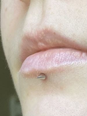 Titanium Internally Threaded Spike End Customer Photo